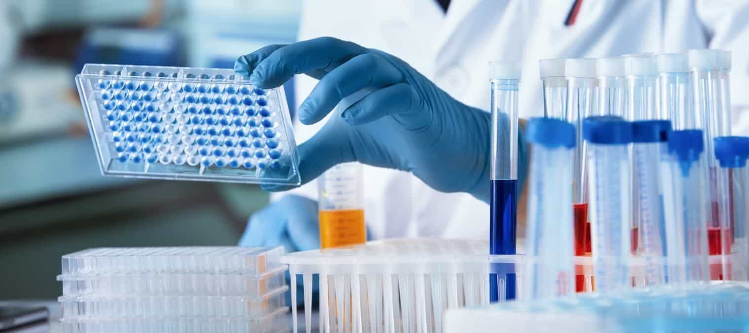 Laboratory sample processing